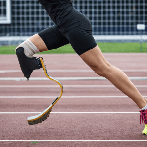 El paper clau del plàstic en les pròtesis modernes El paper clau del plàstic en les pròtesis modernes