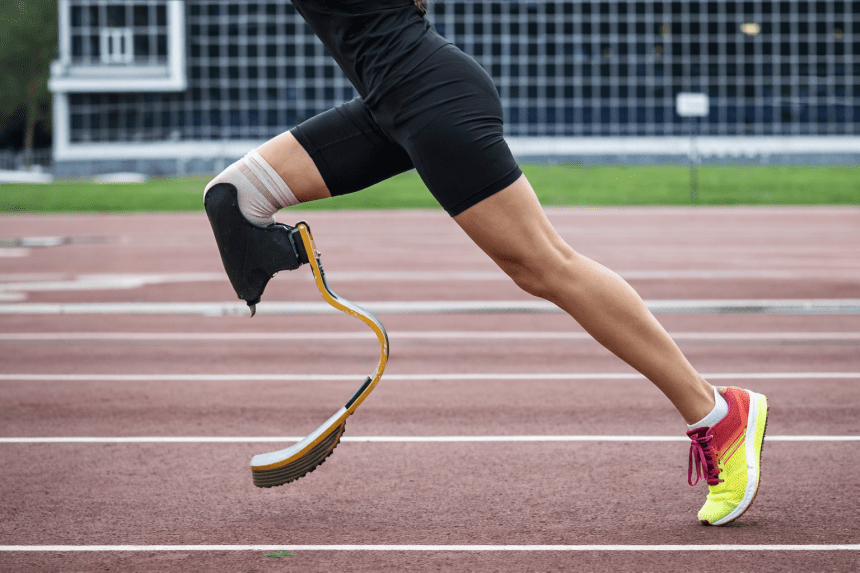 El paper clau del plàstic en les pròtesis modernes El paper clau del plàstic en les pròtesis modernes