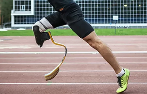 Prosthetics20Image2012072dpi El paper clau del plàstic en les pròtesis modernes